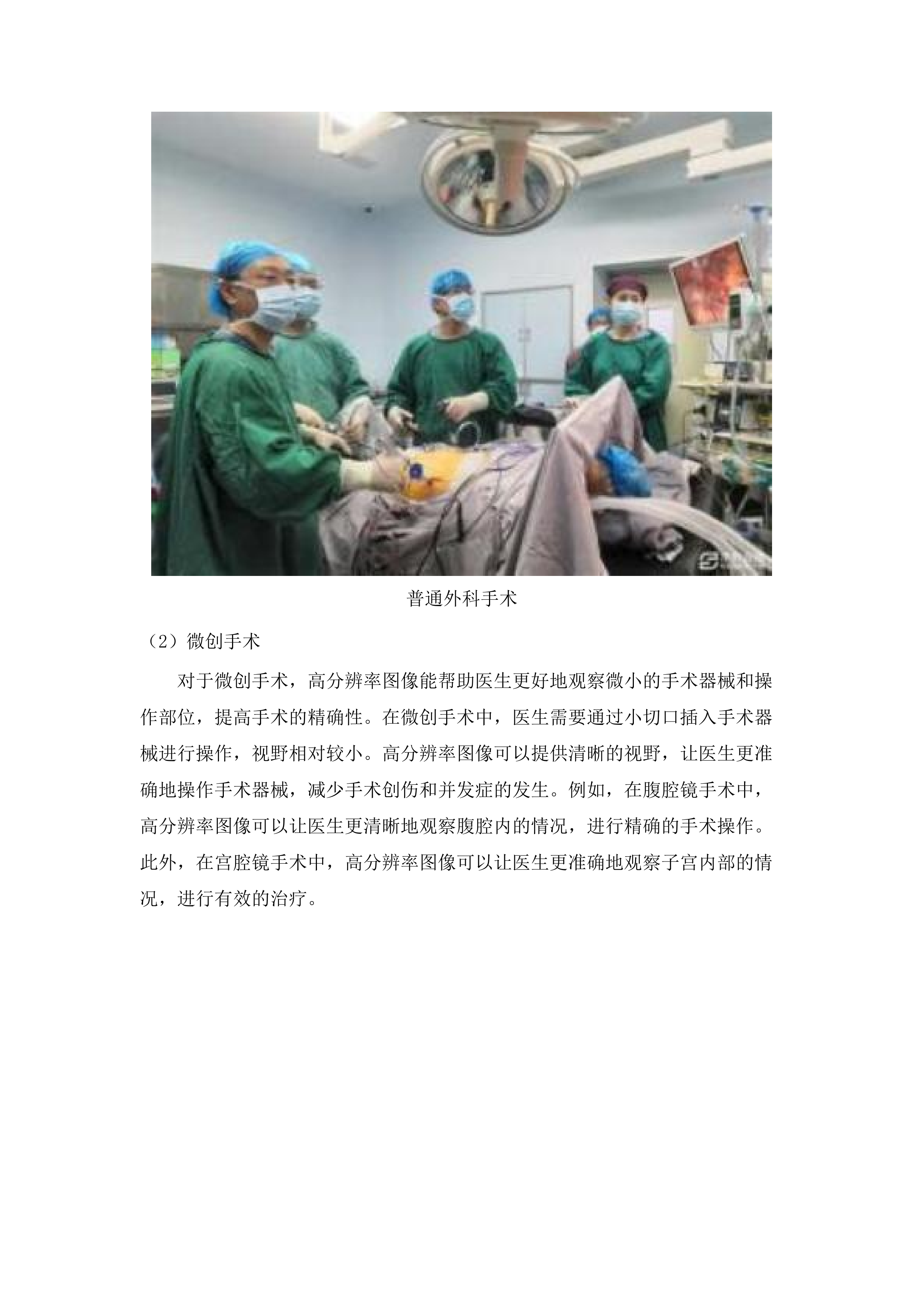 4K腹腔镜.docx 第10页