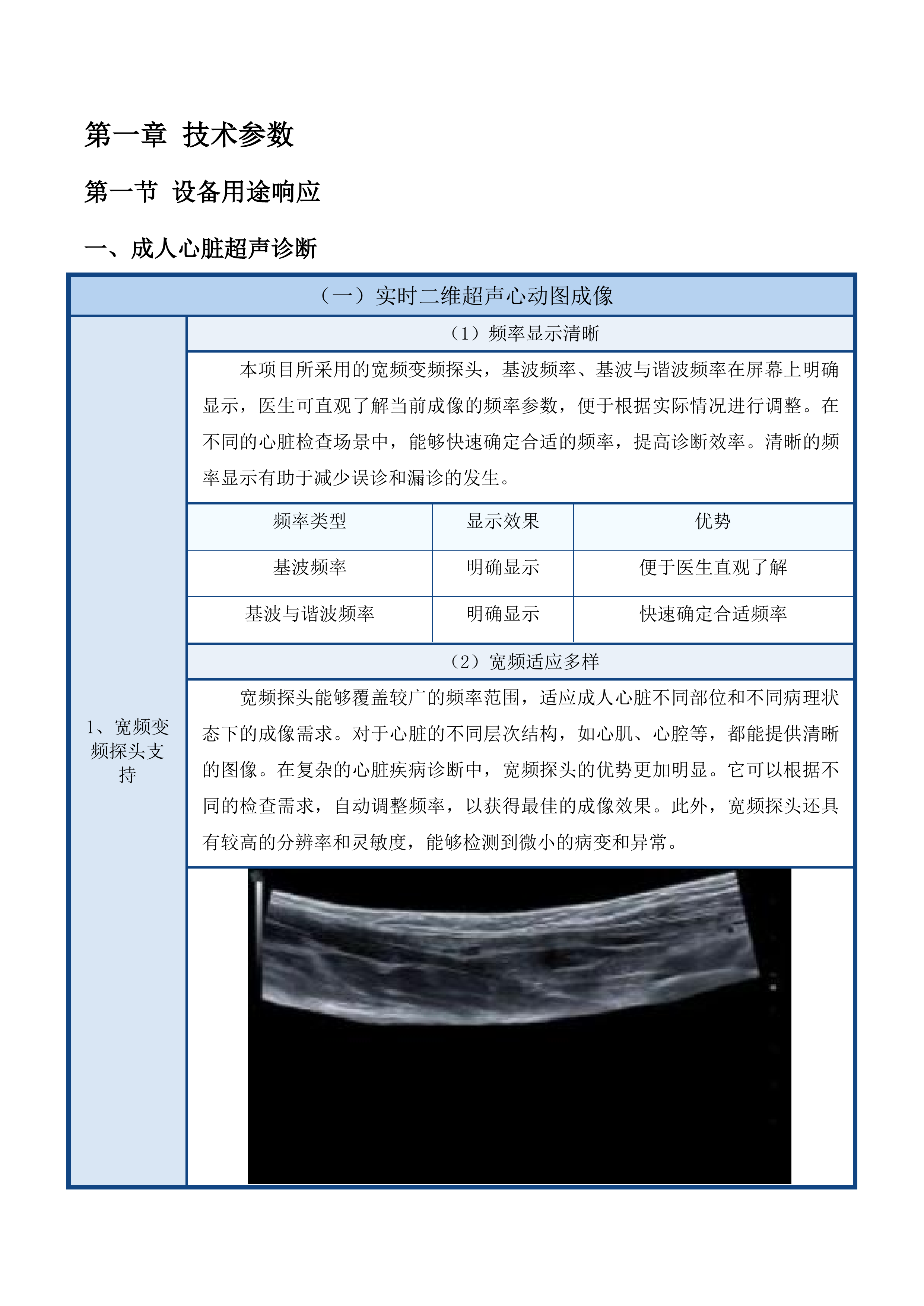 心脏彩超投标方案.docx 第8页