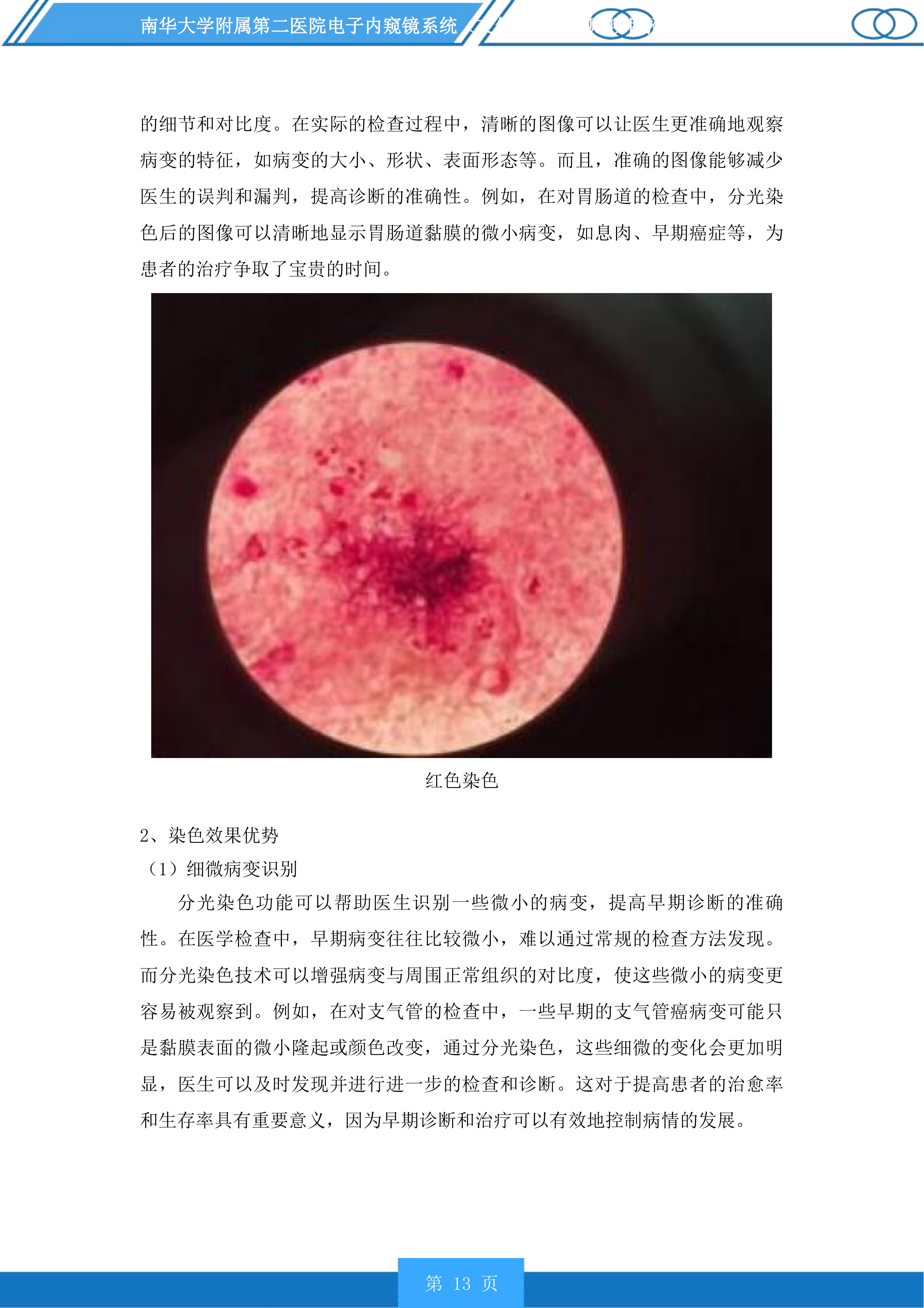 南华大学附属第二医院电子内窥镜系统（支气管镜）采购项目投标方案.docx 第13页