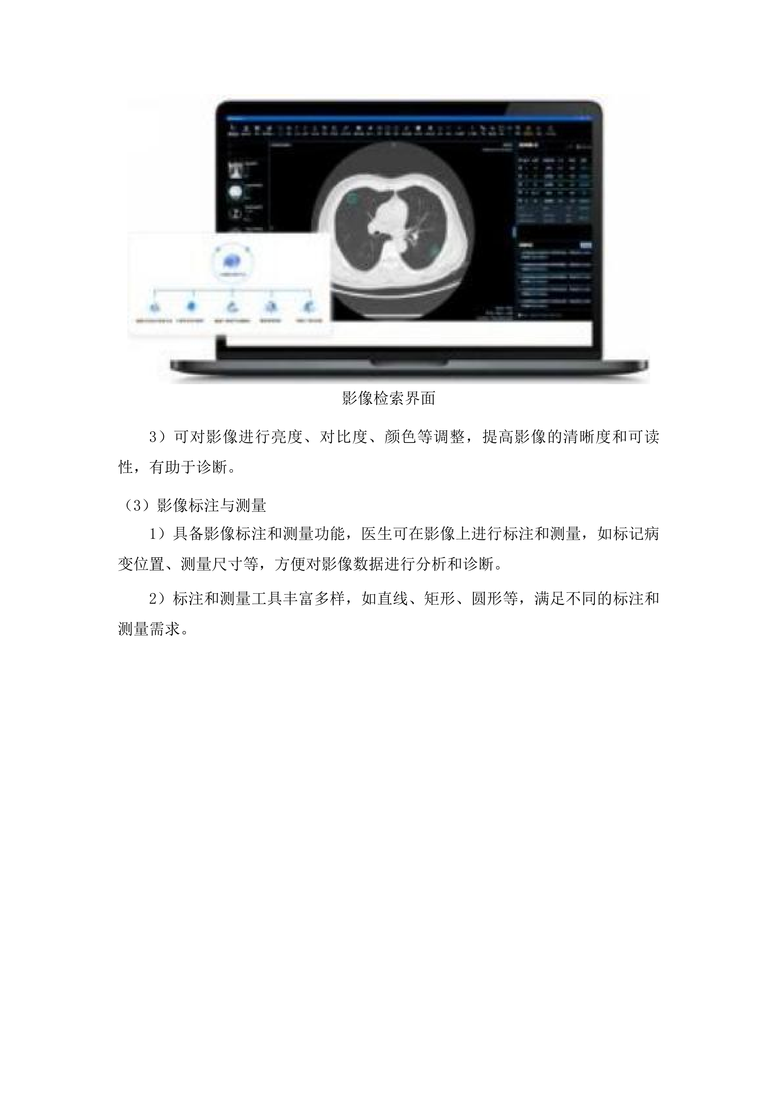 冠脉介入中心核心专科设备购置投标方案.docx 第12页