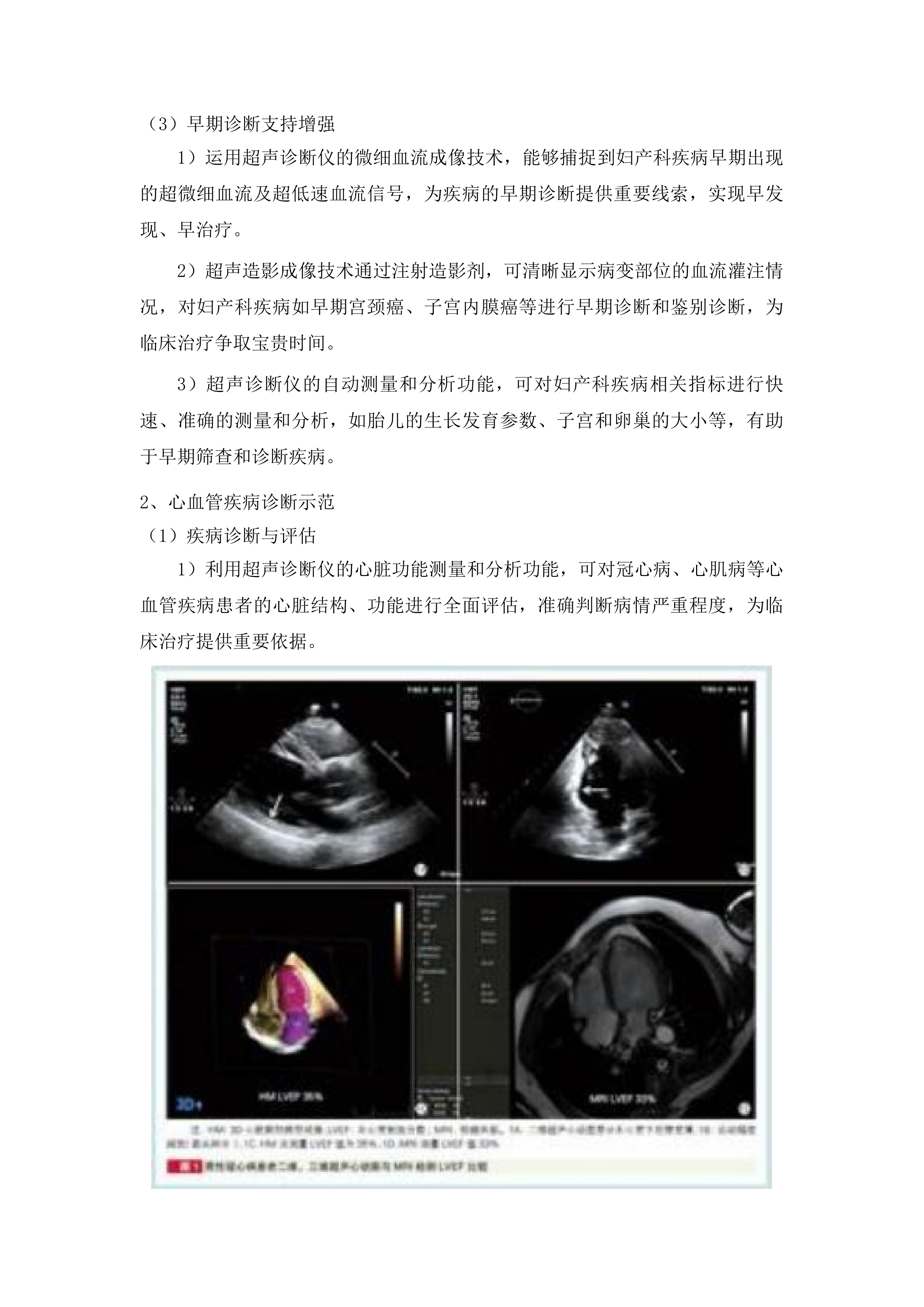 天柱县人民医院全数字化高端彩色多普勒超声诊断仪采购项目投标方案.docx 第5页