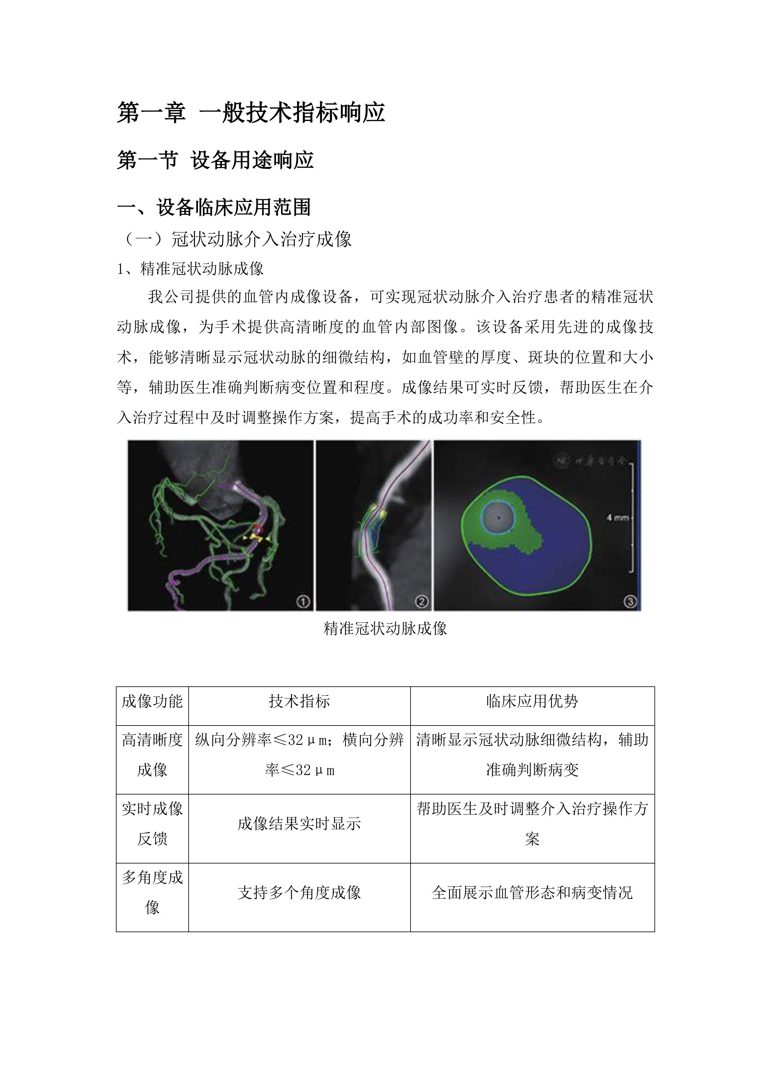 广西壮族自治区人民医院血管内成像设备采购项目投标方案.docx 第8页