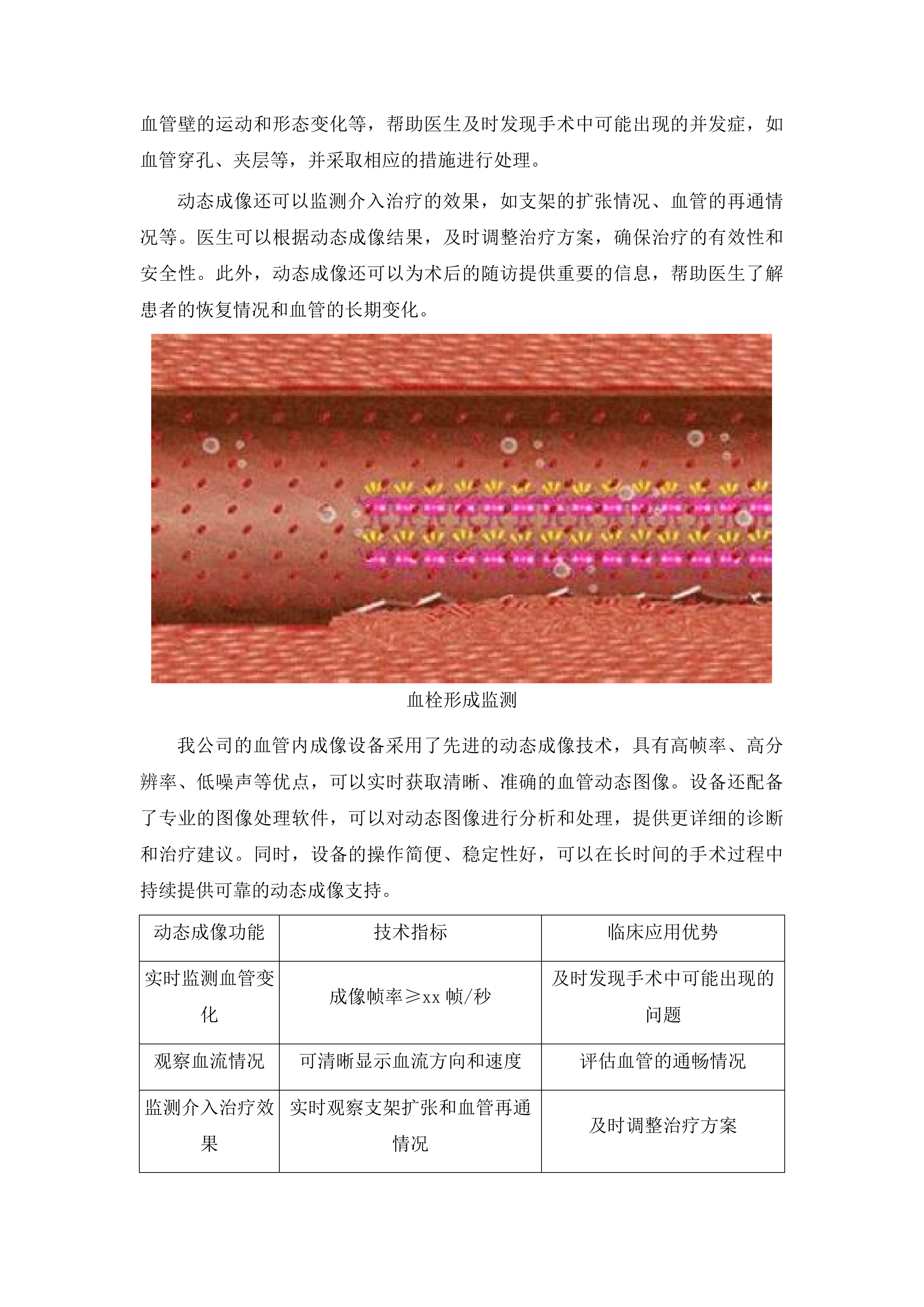 广西壮族自治区人民医院血管内成像设备采购项目投标方案.docx 第10页