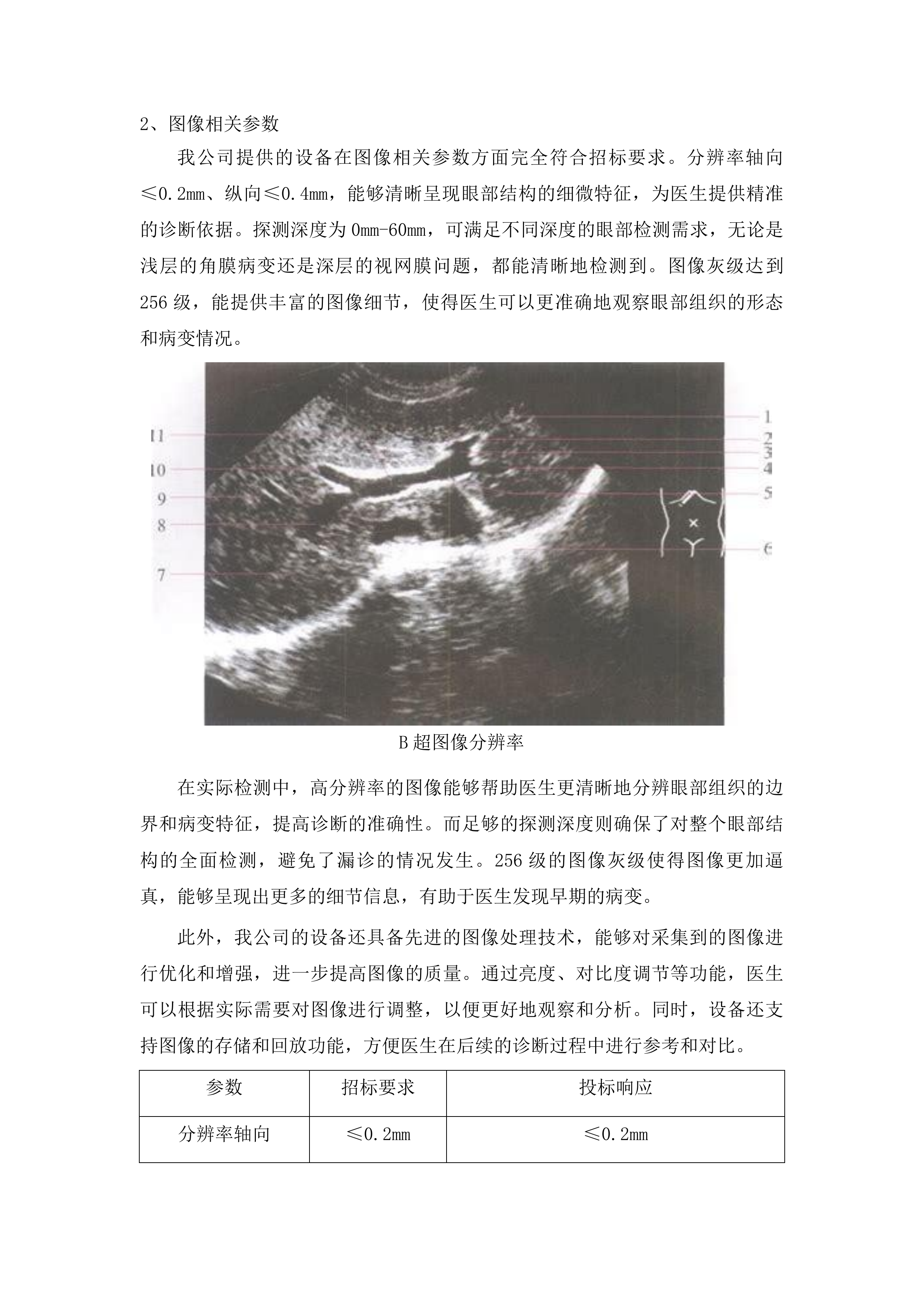 青海国家区域医疗中心和国家紧急医学救援基地建设项目眼科光学相干断层扫描仪等医疗设备采购投标方案.docx 第6页